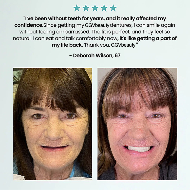 🦷  Fit Full Functional DenturesMake you more confident